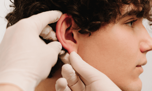 Vedanu wellness | facial plastic surgery procedures