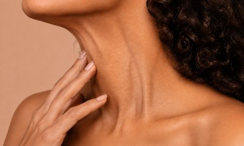 necklift2 Vedanu wellness | neck lift