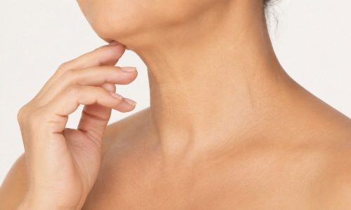 necklift3 Vedanu wellness | neck lift